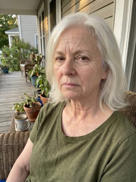 Bárbara, 64 anos - antes do ritual KoreanSkin