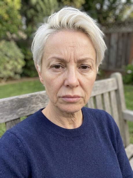 Denise, 55 anos - antes do ritual KoreanSkin