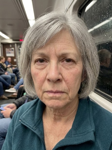Helena, 62 anos - antes do ritual KoreanSkin