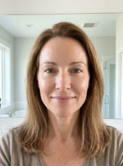 Susana, 52 anos - depois · 21 noites do ritual KoreanSkin