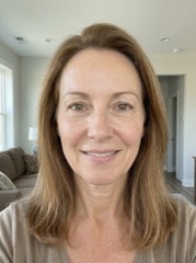 Susana, 52 anos - antes do ritual KoreanSkin